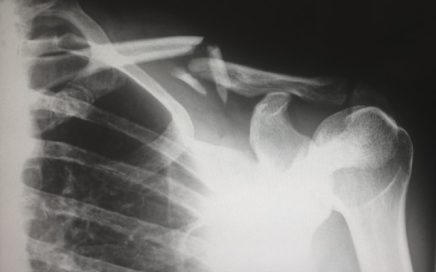 Máquina de Rayos X: Innovaciones Tecnológicas en el Diagnóstico Médico