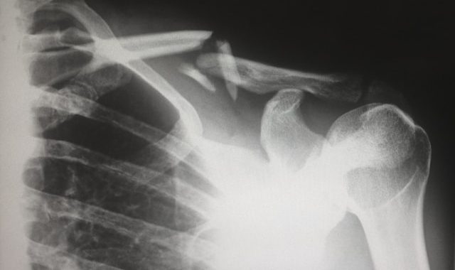 Máquina de Rayos X: Innovaciones Tecnológicas en el Diagnóstico Médico